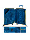 Set Rigid Suitcases Lois Zion color set capacity 140 L